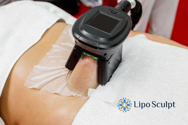 Does Fat Freezing at Home Work? DIY Devices vs Professional Cryolipolysis 1 How is professional cryolipolysis different Warley?