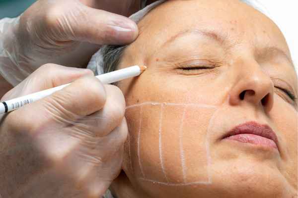 CryoPen: 5 Skin Concerns It May Be Used to Treat 4 What should you ask before having CryoPen treatment Warley?